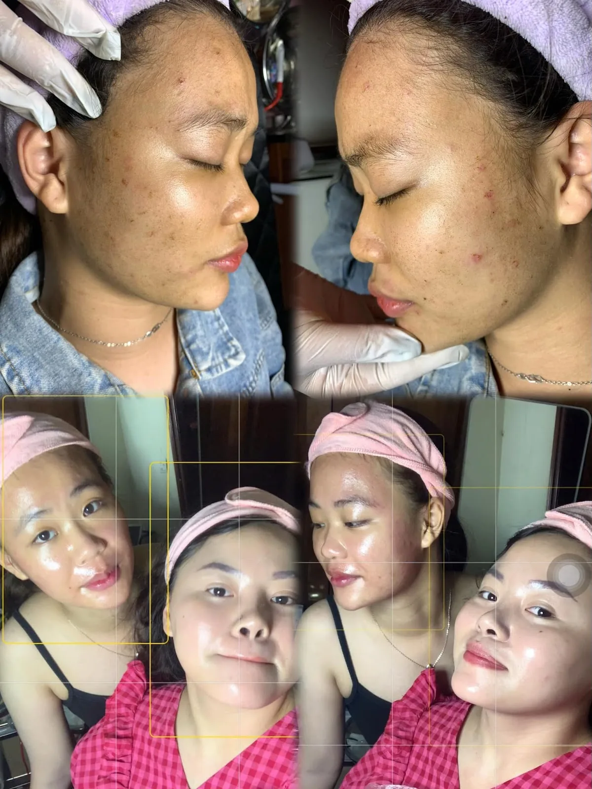 Ảnh 2 — Thùy Linh Beauty Spa & Cosmetic