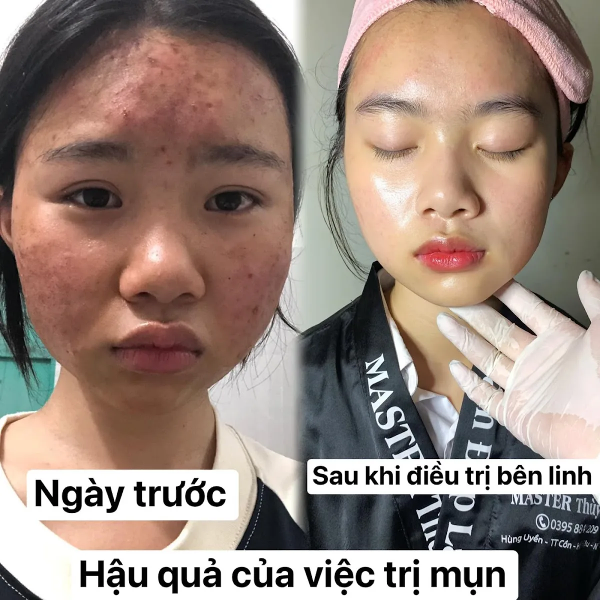 Ảnh 3 — Thùy Linh Beauty Spa & Cosmetic
