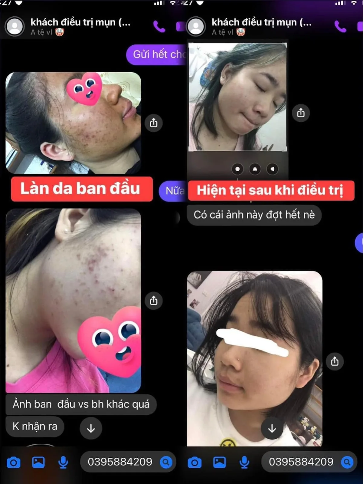 Ảnh 4 — Thùy Linh Beauty Spa & Cosmetic